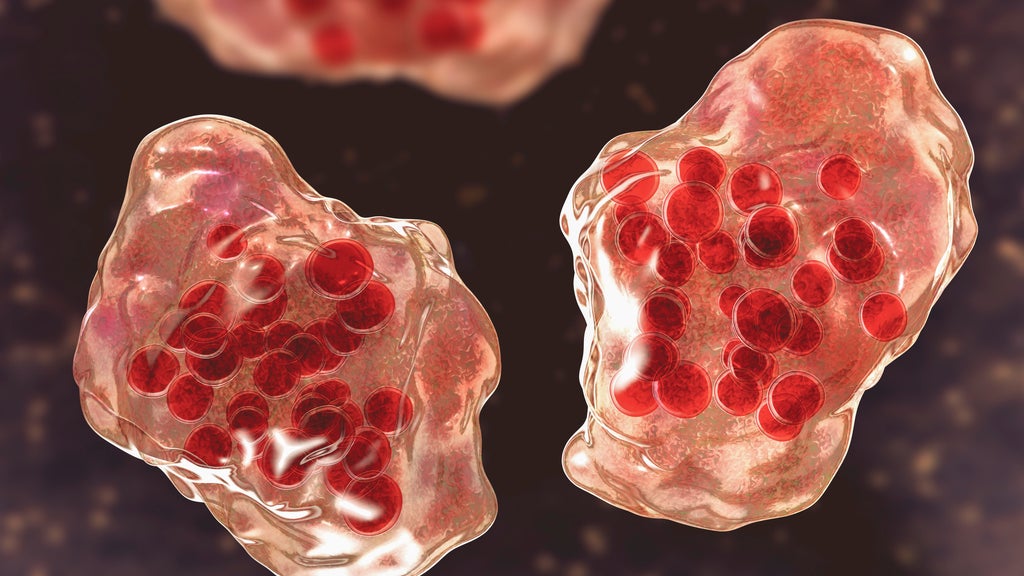 Central Minnesota county reports "several cases of suspected measles" — WCCO / CBS Minnesota, Rosemount Health news